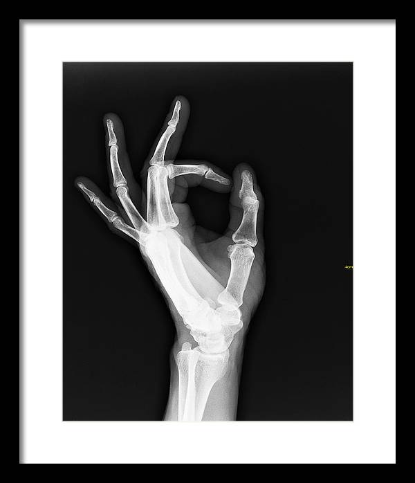 Roentgenogram or Medical X-ray image / Art Photo - Framed Print