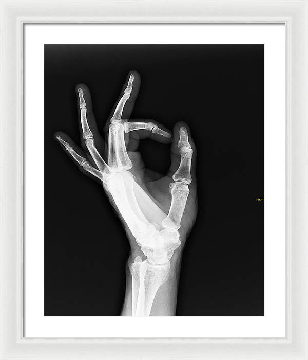 Roentgenogram or Medical X-ray image / Art Photo - Framed Print