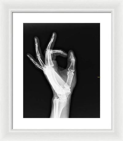 Roentgenogram or Medical X-ray image / Art Photo - Framed Print