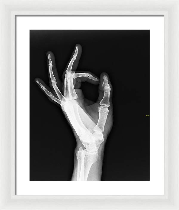 Roentgenogram or Medical X-ray image / Art Photo - Framed Print