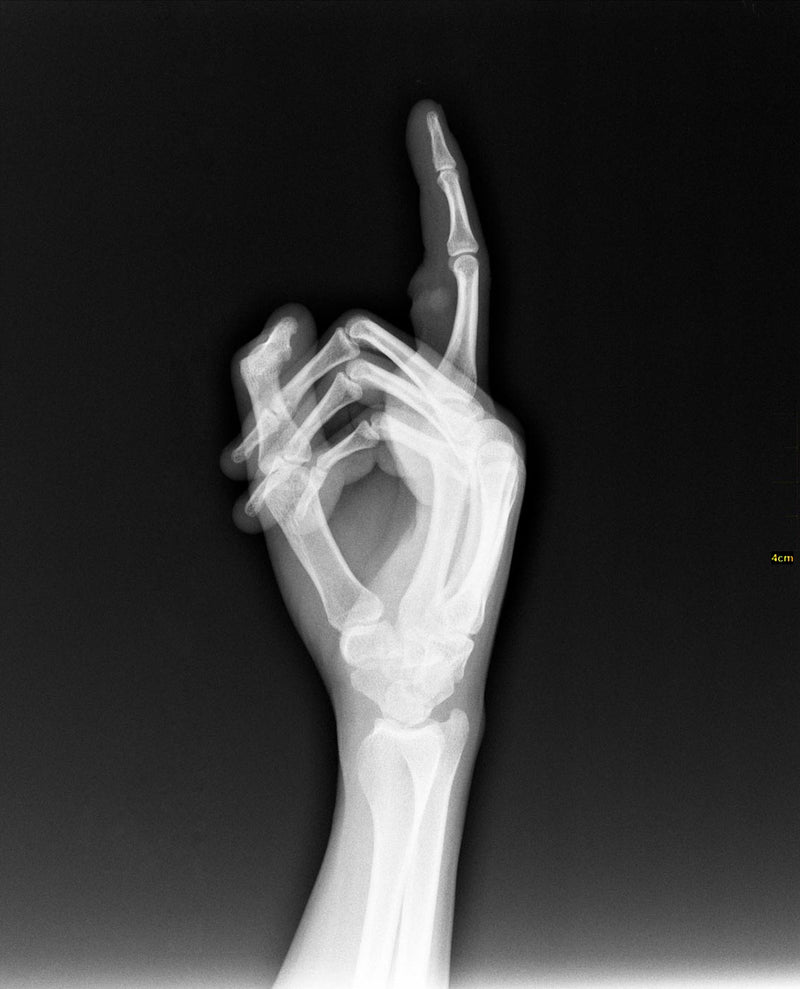Roentgenogram or Medical X-ray image