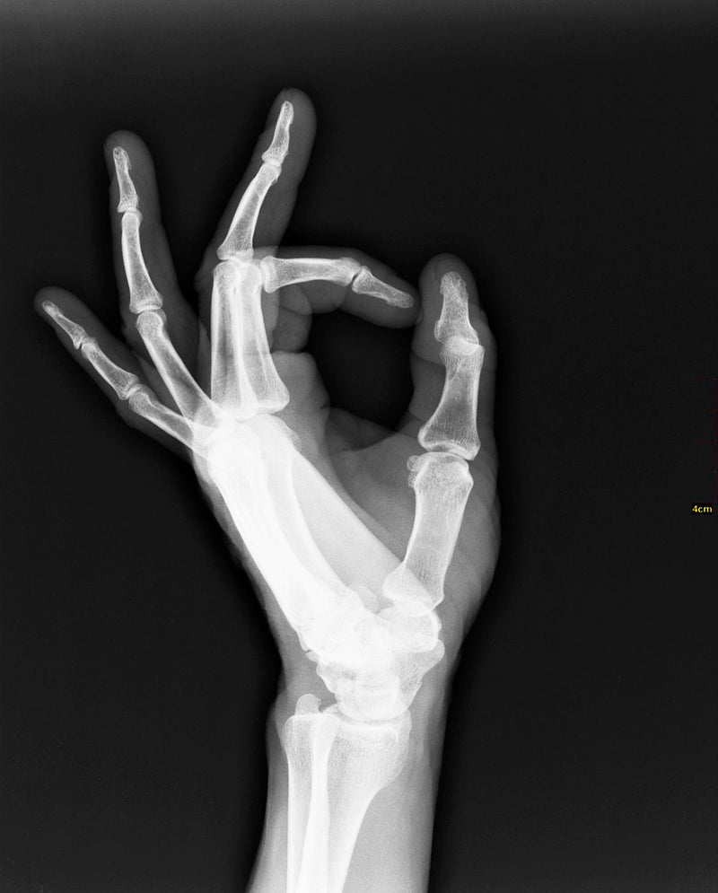 Roentgenogram or Medical X-ray image