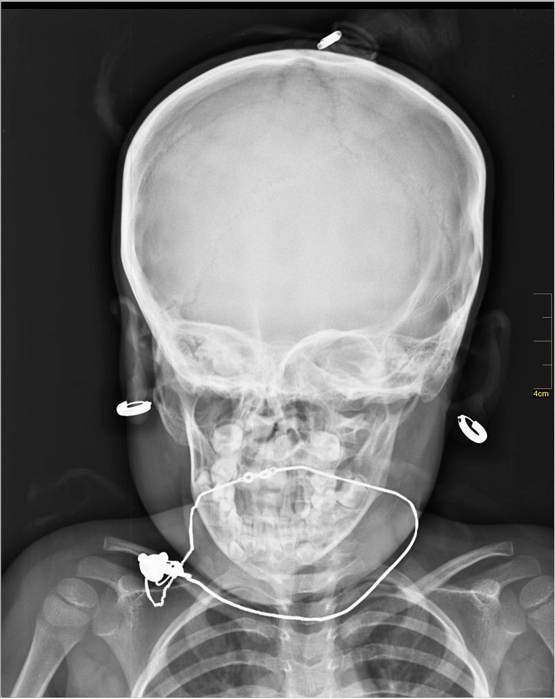 Medical X-ray Image