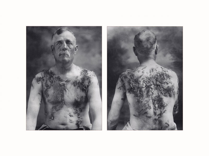 John Meints, Tarred and Feathered, 1918 - diptych