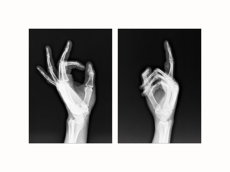 X-ray - diptych