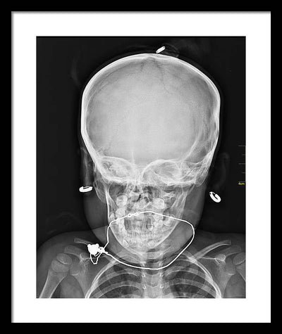 Medical X-ray Image / Art Photo - Framed Print