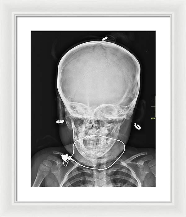 Medical X-ray Image / Art Photo - Framed Print