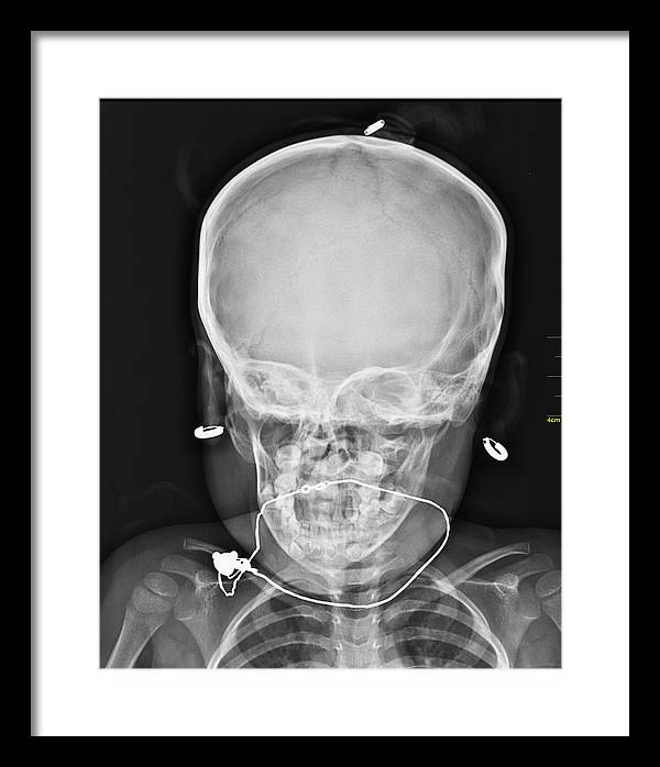 Medical X-ray Image / Art Photo - Framed Print