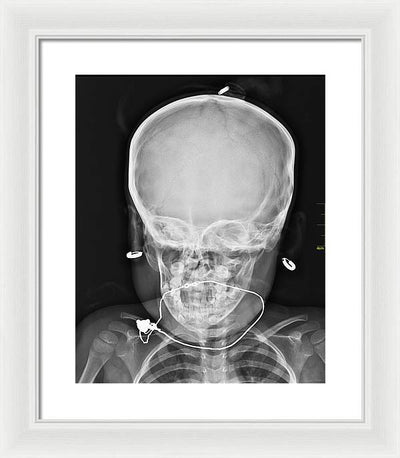 Medical X-ray Image / Art Photo - Framed Print