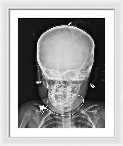 Medical X-ray Image / Art Photo - Framed Print