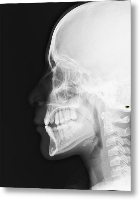 Medical X-ray / Art Photo - Metal Print