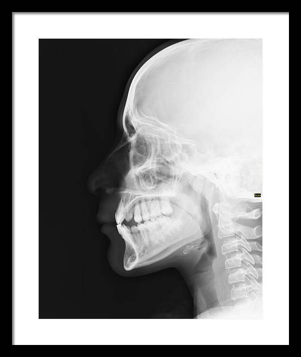 Medical X-ray / Art Photo - Framed Print