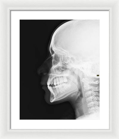 Medical X-ray / Art Photo - Framed Print