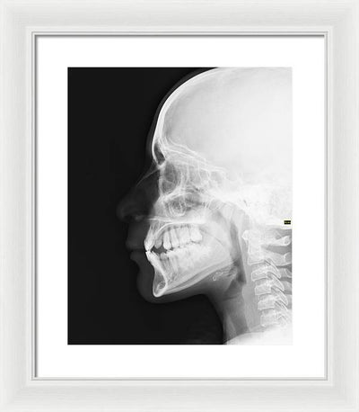 Medical X-ray / Art Photo - Framed Print