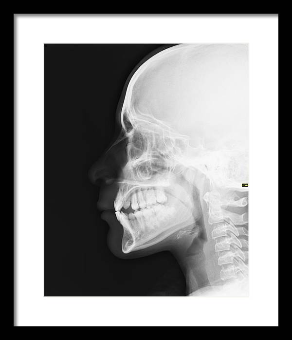 Medical X-ray / Art Photo - Framed Print