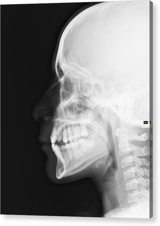 Medical X-ray / Art Photo - Acrylic Print