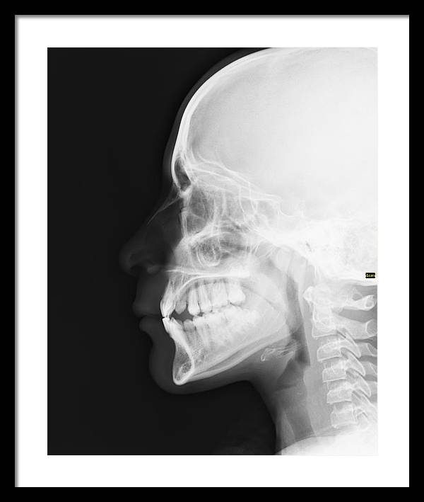 Medical X-ray / Art Photo - Framed Print