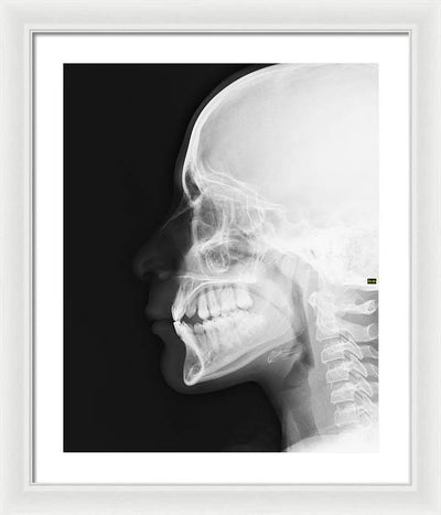 Medical X-ray / Art Photo - Framed Print