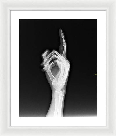 Roentgenogram or Medical X-ray image / Art Photo - Framed Print