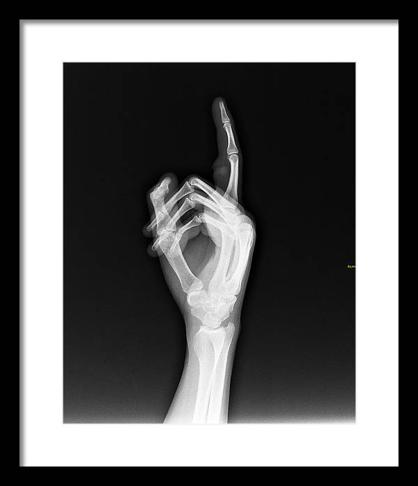 Roentgenogram or Medical X-ray image / Art Photo - Framed Print