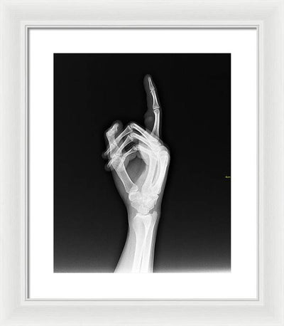 Roentgenogram or Medical X-ray image / Art Photo - Framed Print