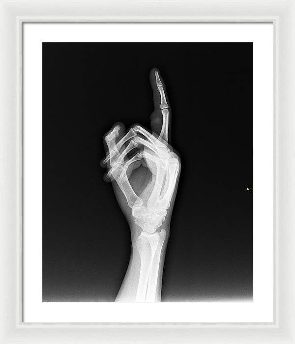 Roentgenogram or Medical X-ray image / Art Photo - Framed Print